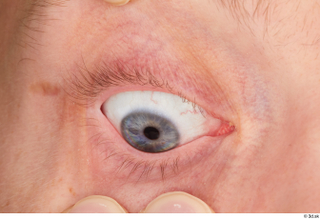 Stanley Johnson eye 0011.jpg